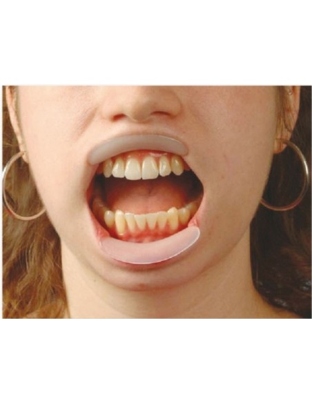 Divaricatore orale labiale